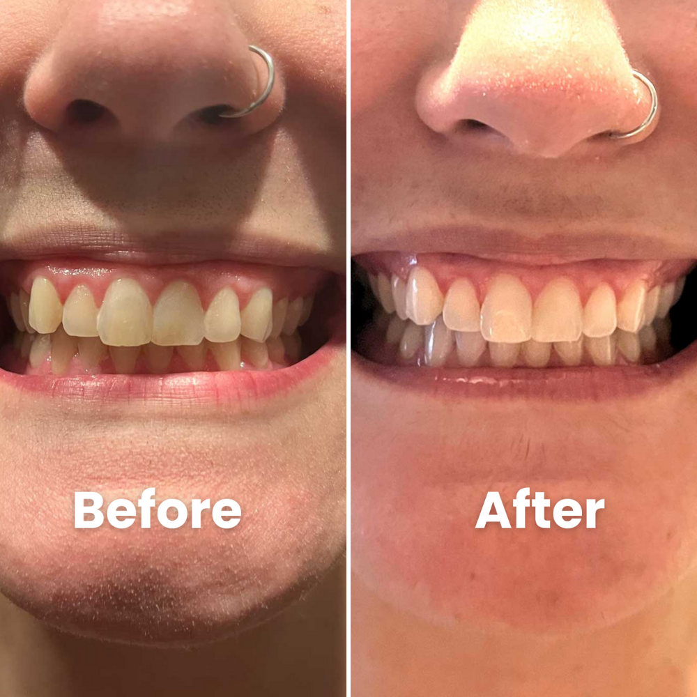 SOVARA Teeth Whitening Powder