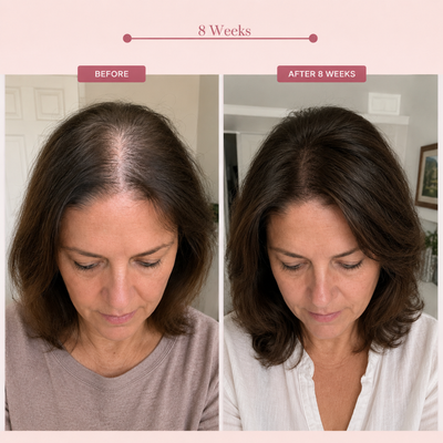 PDRN Hair Serum