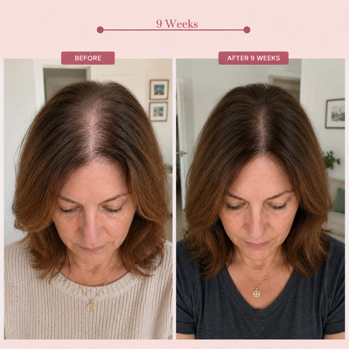 PDRN Hair Serum