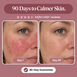Sea Buckthorn Capsules for Rosacea