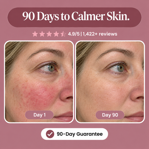 Sea Buckthorn Capsules for Rosacea