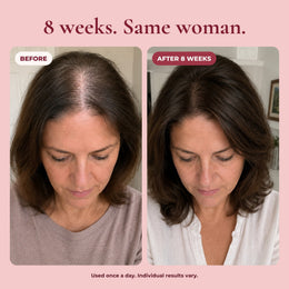 PDRN Hair Serum